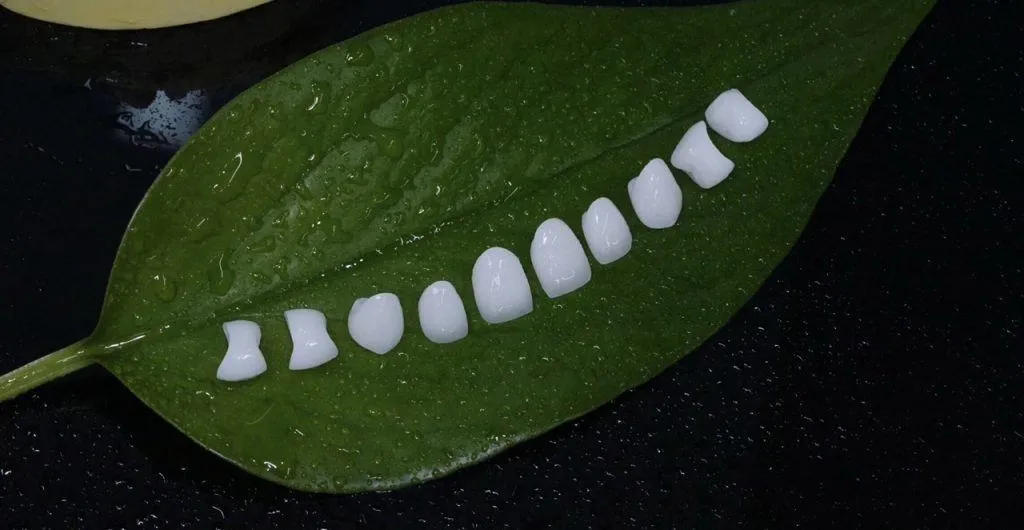 boc-rang-su-bao-nhieu-tien-1-rang-1