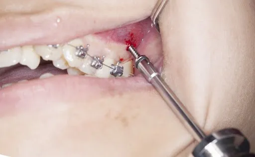 vit-chinh-nha-thai-nguyen