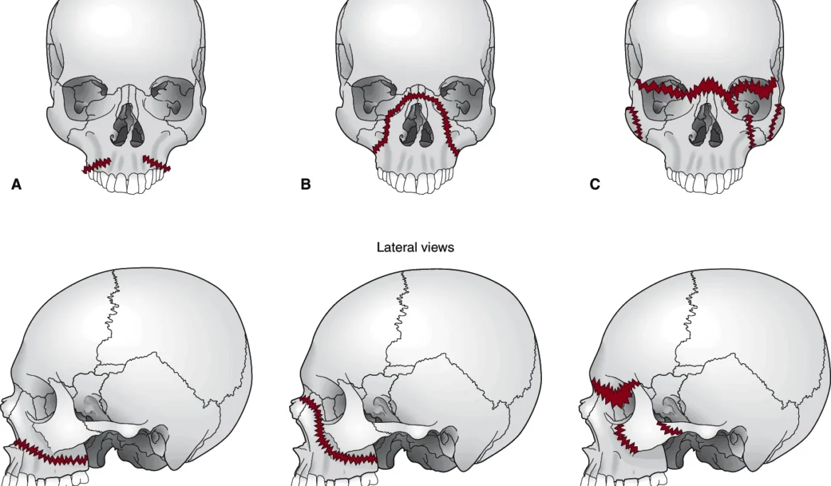 chan-thuong-vung-mat-1