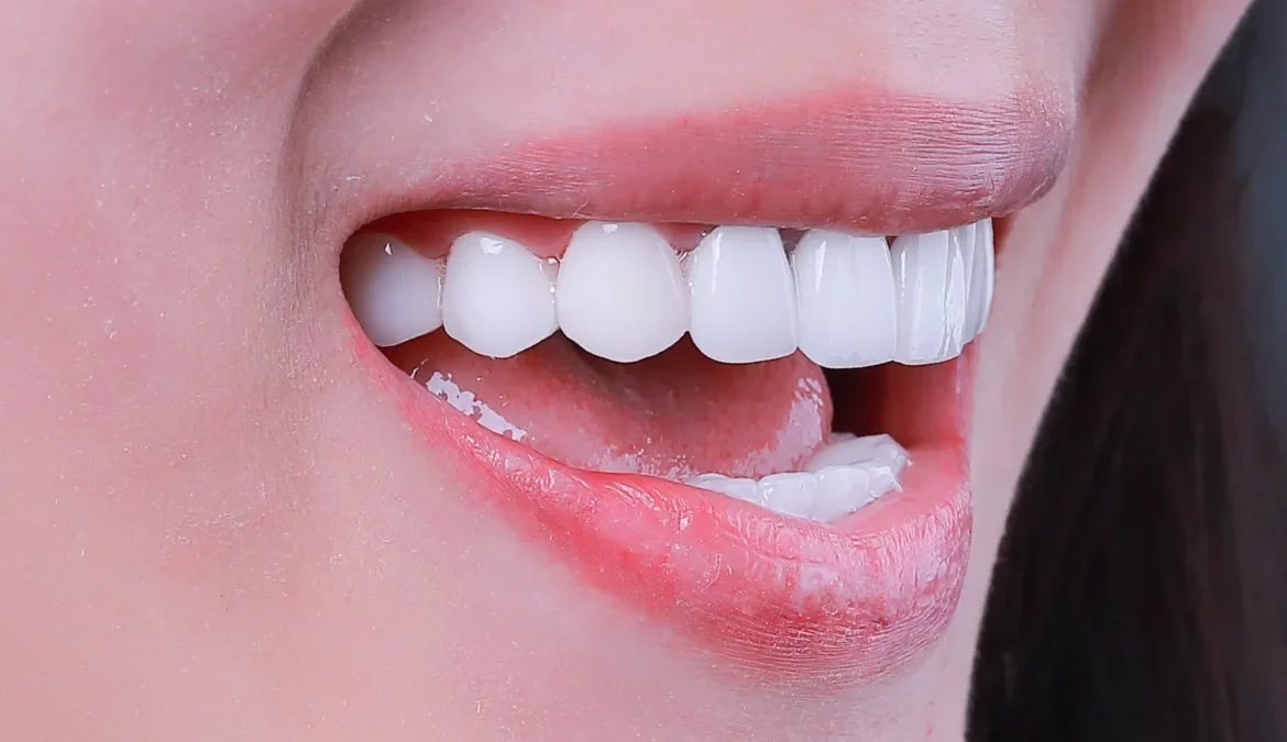 các mẹo làm trắng răng