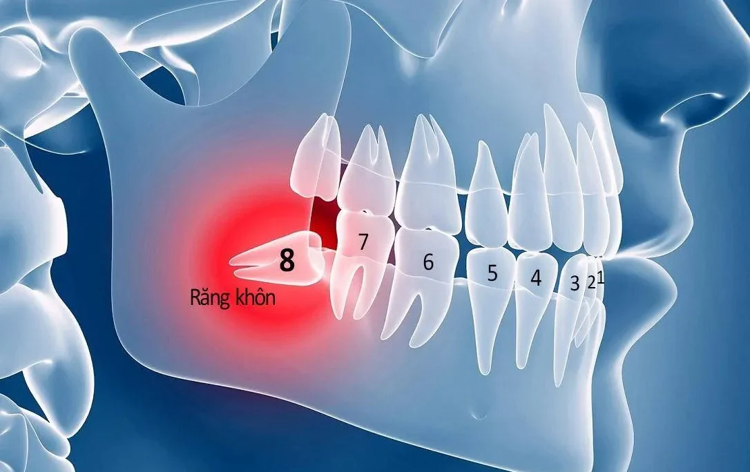 nho rang khon o dau