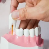 mọc răng cấm